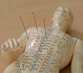 Eastern Healing acupuncture services.jpg